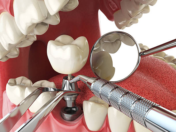 Best Emergency Dental Care for Broken or Chipped Teeth in , LA
